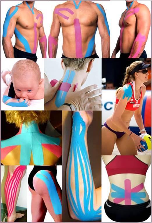 FISIO KINESIO TAPING