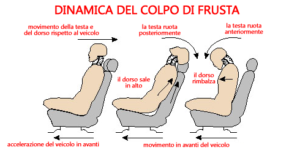 dinamica-del-colpo-di-frusta