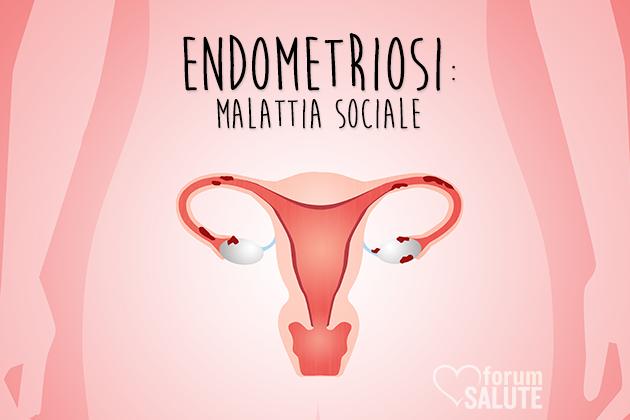 Endometriosi