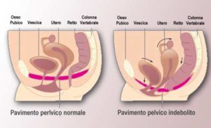 pavimento-pelvighrhco