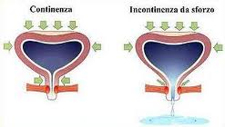 riabilitazione-vescicale2