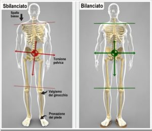 sindrome-gamba-corta