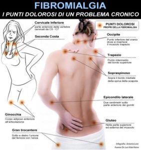 fibromialgia